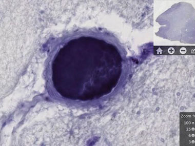 Now, take a look at Einstein's brain on your iPad for $9.99 Now, take a look at Einstein's brain on your iPad for $9.99