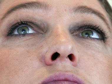 Blinding amoeba targets contact lens users Blinding amoeba targets contact lens users