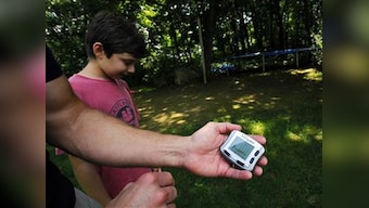 Analysis links psoriasis to diabetes