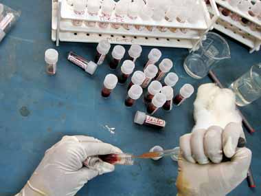 Soon, a drug to boost blood circulation Soon, a drug to boost blood circulation