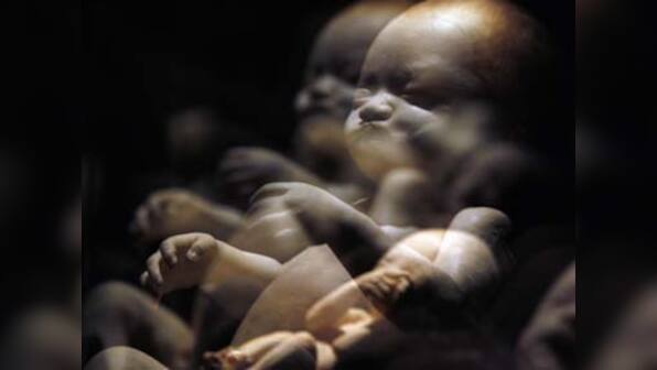 Now, a blood test can detect Down's syndrome in unborn babies