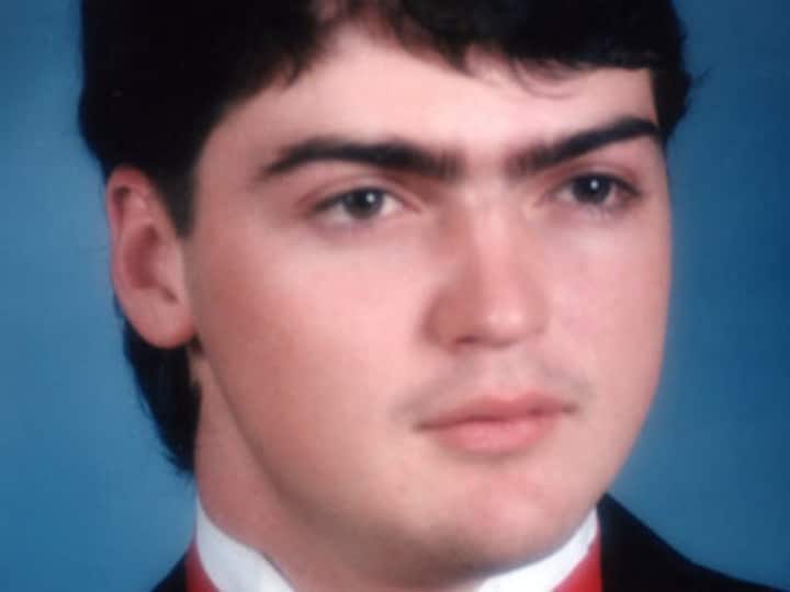 World's most extensive transplant gives US man new face
