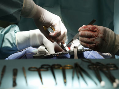 Capping stent prices at Rs 35,000 is a good move by Narendra Modi govt, but will it stem corruption? Capping stent prices at Rs 35,000 is a good move by Narendra Modi govt, but will it stem corruption?