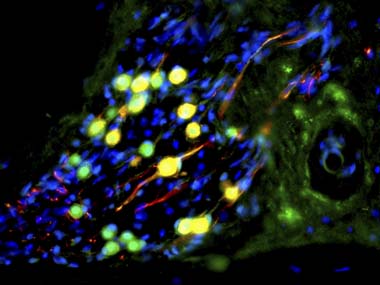 Scientists convert specific brain cells to neurons Scientists convert specific brain cells to neurons