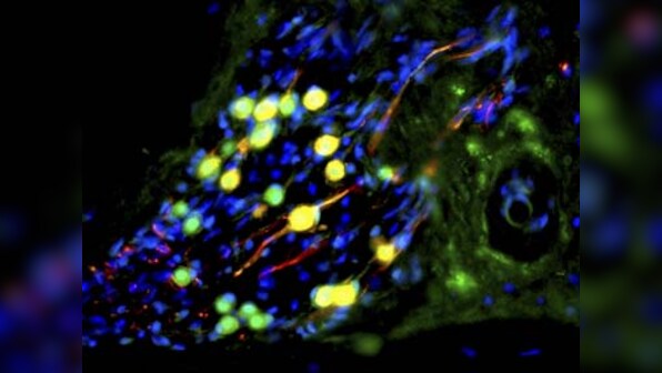 Scientists convert specific brain cells to neurons