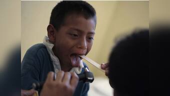 Now, dissolvable oral strip to soothe mouth burns 