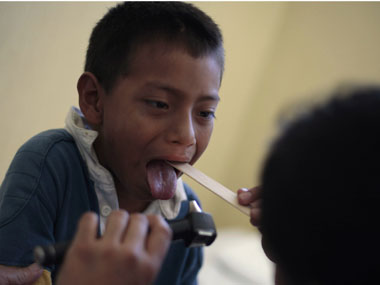 Now, dissolvable oral strip to soothe mouth burns Now, dissolvable oral strip to soothe mouth burns