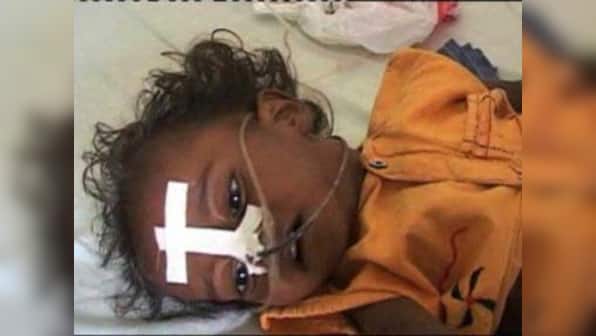 Encephalitis epidemic: Why India’s response is falling apart