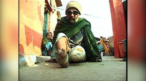 World Leprosy Day 2022: All you need to know about the theme, history and significance 