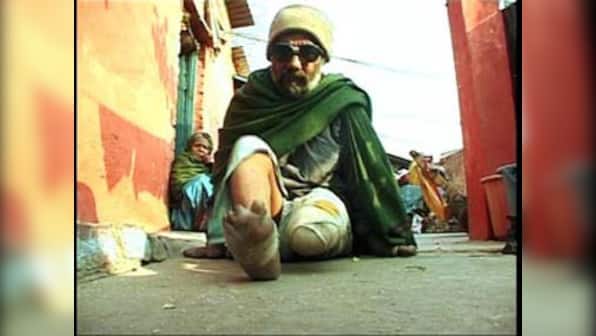 World Leprosy Day 2022: All you need to know about the theme, history and significance 