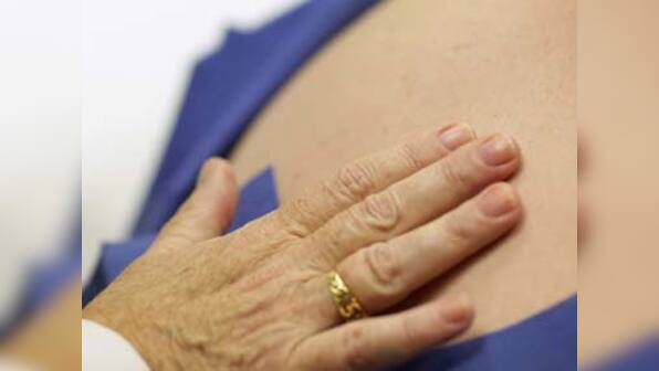 How taking a 'selfie' can cure skin problems