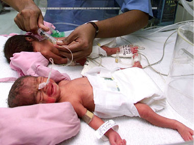 Is pre-mature birth related to memory, learning problems? Is pre-mature birth related to memory, learning problems?