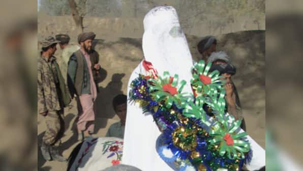 Delhi gives 61-year-old Afghan man a face-lift before wedding