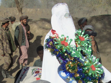 Delhi gives 61-year-old Afghan man a face-lift before wedding Delhi gives 61-year-old Afghan man a face-lift before wedding