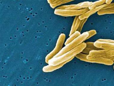 'Your kitchen sponge is 200,000 times more filthy than your toilet seat'