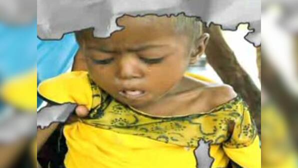 Malnutrition or beauty conscious in Modi's Gujarat?