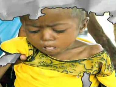 Malnutrition or beauty conscious in Modi's Gujarat? Malnutrition or beauty conscious in Modi's Gujarat?