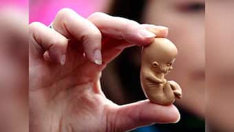 Catholic hospital says foetus not a person; Colorado bishops to review