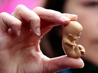 Catholic hospital says foetus not a person; Colorado bishops to review Catholic hospital says foetus not a person; Colorado bishops to review