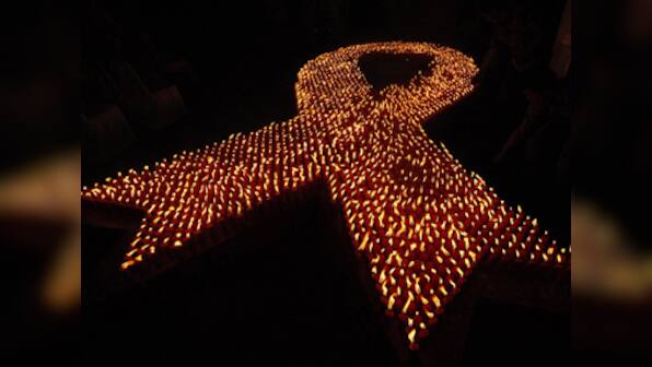 HIV cure: Why it needs to be tempered with caution
