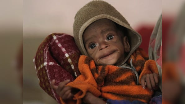 Guess which state improved most in malnutrition? Gujarat