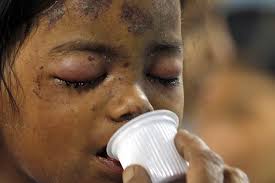 The four-year-old miracle survivor of the Thane building collapse. Image: ibnlive