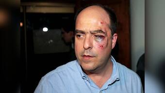 Politicians fight in Venezuela, one severely bruised