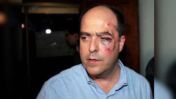Politicians fight in Venezuela, one severely bruised