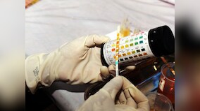 UK-based doctors develop simple kit to test cervical cancer; ailment claims almost 270,000 lives every year