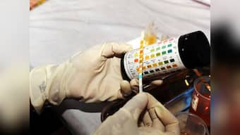 UK-based doctors develop simple kit to test cervical cancer; ailment claims almost 270,000 lives every year