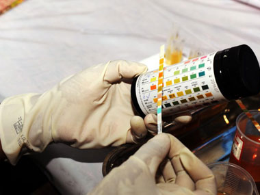 Now, a urine test may be able to diaganose breast cancer Now, a urine test may be able to diaganose breast cancer