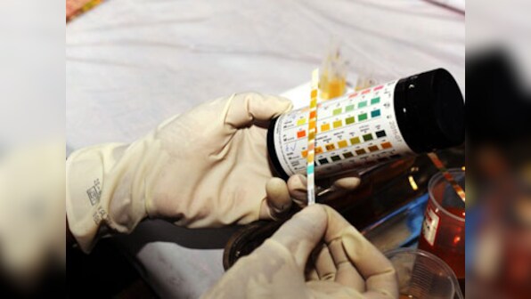 UK-based doctors develop simple kit to test cervical cancer; ailment claims almost 270,000 lives every year
