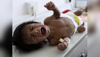 '8,02,000 infants died in India in 2017': UN report claims gender gap in surviving girl child dropped significantly