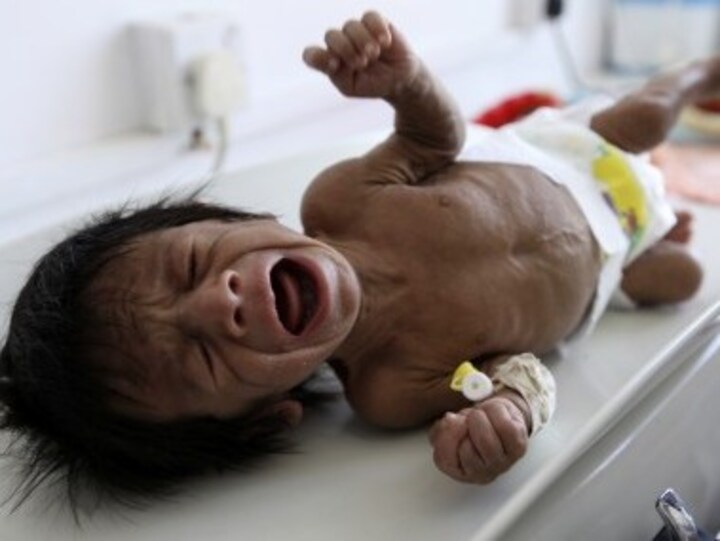 '8,02,000 infants died in India in 2017': UN report claims gender gap in surviving girl child dropped significantly