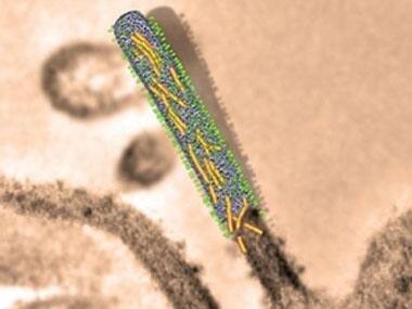 The three-dimensional structure of respiratory syncytial virus. Science Daily.