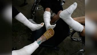 Jadavpur university discovers new biomaterial that stimulates bone growth