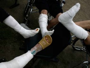 Jadavpur university discovers new biomaterial that stimulates bone growth Jadavpur university discovers new biomaterial that stimulates bone growth