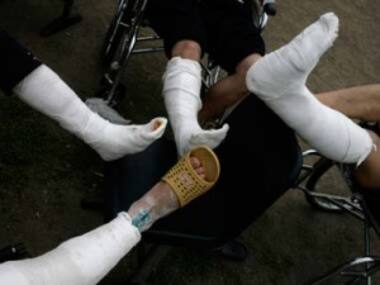 Jadavpur university discovers new biomaterial that stimulates bone growth