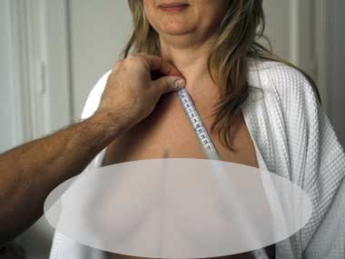 Tackling breast cancer. Reuters