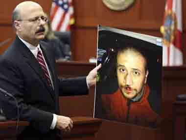 Assistant state attorney Bernie de la Rionda shows a picture of a bloodied George Zimmerman to the jury while presenting the state's closing arguments. AP