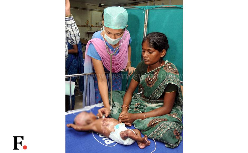 The mother of the boy with doctors in a Chennai hospital. The parents of the boy have claimed that he had gone up in flames twice in the past. Firstpost The mother of the boy with doctors in a Chennai hospital. The parents of the boy have claimed that he had gone up in flames twice in the past. Firstpost