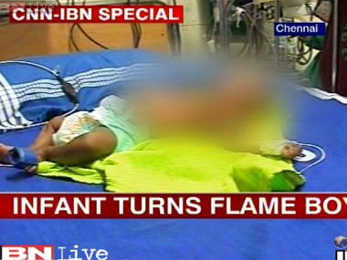 Can alcoholism, diabetes lead to spontaneous human combustion? Can alcoholism, diabetes lead to spontaneous human combustion?