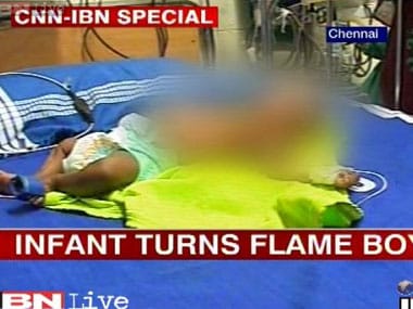 Can alcoholism, diabetes lead to spontaneous human combustion?