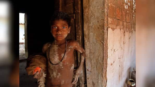 That déjà vu feeling: A tribal child dies of malnutrition 