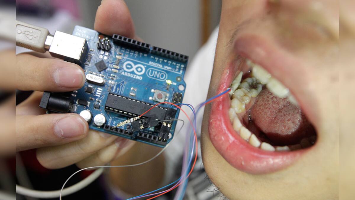 Photos: A 'Smart tooth' that checks if you're overeating! – Firstpost