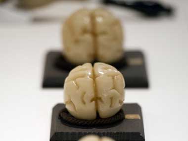 First time ever: Scientists 'switch off' consciousness in a patient's brain First time ever: Scientists 'switch off' consciousness in a patient's brain