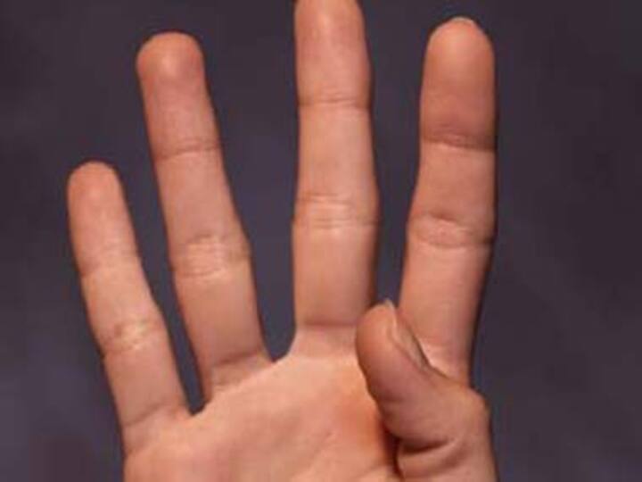 Have an Aadhaar card? Axis Bank now allows e-KYC to open account Have an Aadhaar card? Axis Bank now allows e-KYC to open account