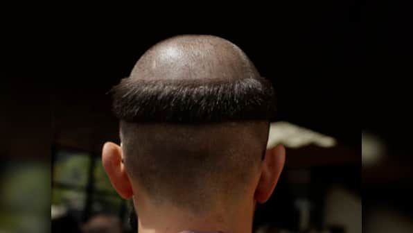 Are you going bald? Maybe gravity is to blame