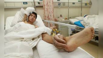 Photos: Doctors save man's hand by grafting it to his ankle