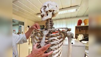 MIT scientists develop technique to stimulate new bone growth 
